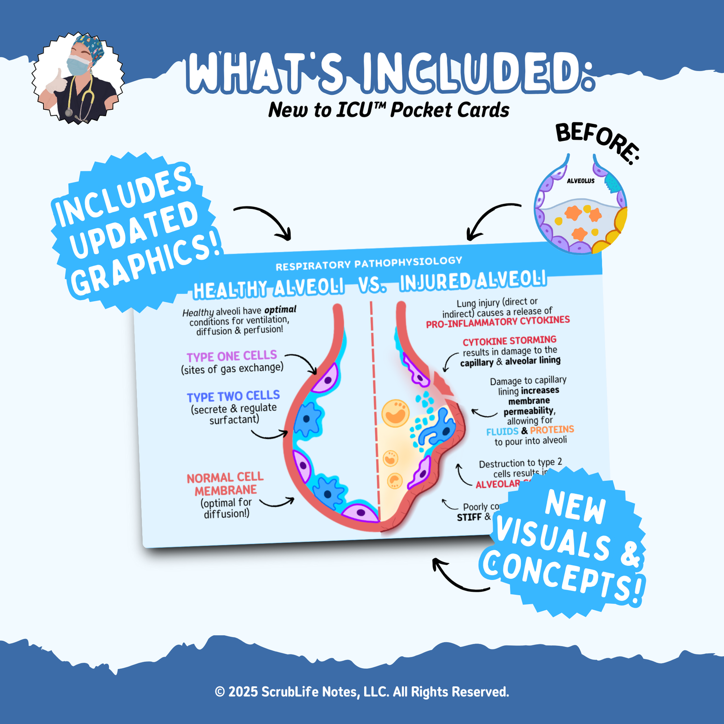 ARDS & Respiratory Failure Pocket Card